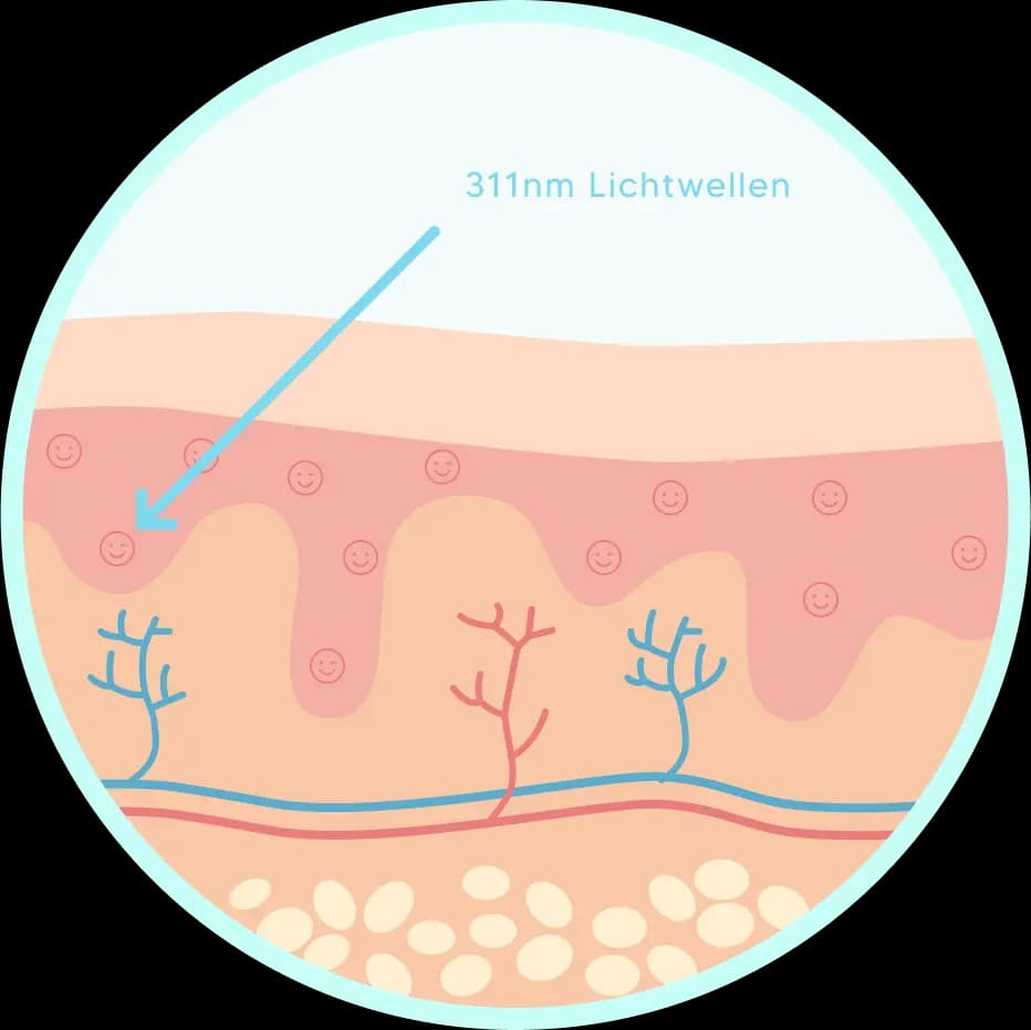 Querschnitt der Haut